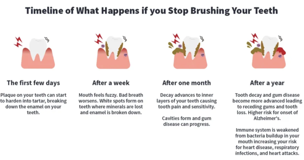 Screenshot 2024 04 05 at 10 42 18 Timeline graphic showing consequences of not brushing teeth early enamel decay bad breath after a week progressive decay after a month and severe decay and gum disease after a year