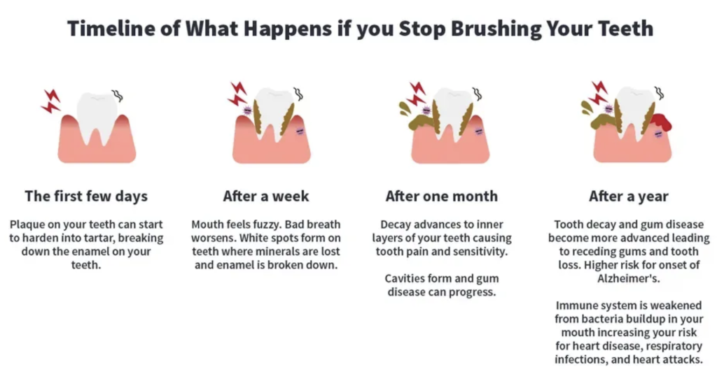Timeline graphic showing dental decay progression days to years after stopping brushing highlighting plaque buildup and gumdental damage